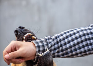 How JUSTICENTER Personal Injury Lawyers Can Help After a Dog Bite Incident in Tarzana